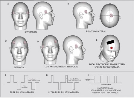 Clear FMGE 2023 with the help of Kings